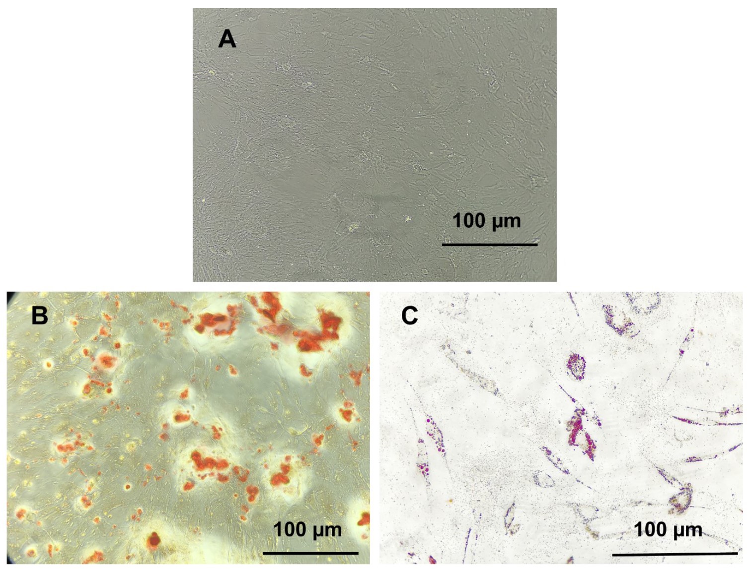 The ability of extracted GA-MSCs to differentiate into adipo and osteocytes